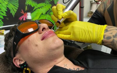 Eliminación de Tatuajes y Micropigmentación: Todo lo que debes saber